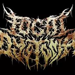 Focal Dystonia