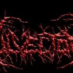 Vulvectomy