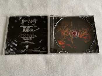 CD Abnormality: Mechanisms Of Omniscience