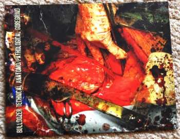 CD Aposepsy: Aposepsy