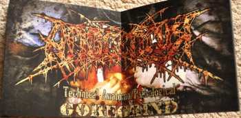CD Aposepsy: Aposepsy
