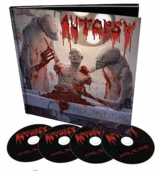 4CD Autopsy: After The Cutting DLX | LTD