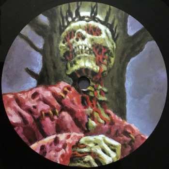 LP Autopsy: Morbidity Triumphant