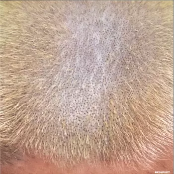 Barnt: ProMetal Fan Decor Only Product