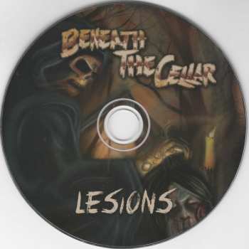 CD Beneath the Cellar: Lesions