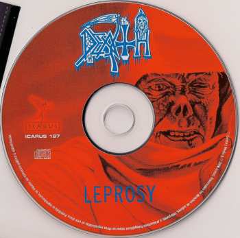 CD Death: Leprosy