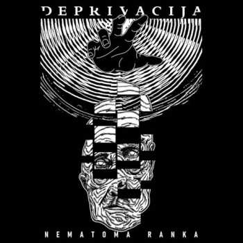 Album Deprivacija: Nematoma Ranka