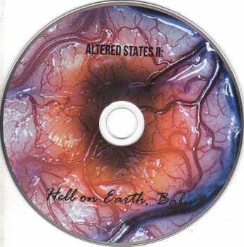 2CD Encephalon: We Only Love You When You're Dead DLX