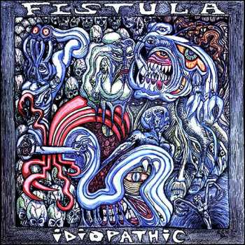 Album Fistula: Idiopathic