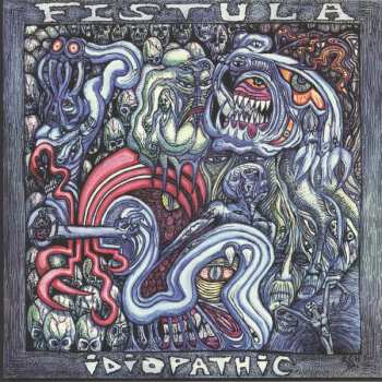 LP Fistula: Idiopathic