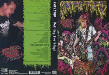 DVD Impetigo: Defiling The Stage LTD