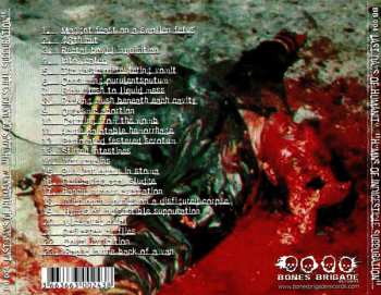 CD Last Days Of Humanity: Hymns Of Indigestible Suppuration