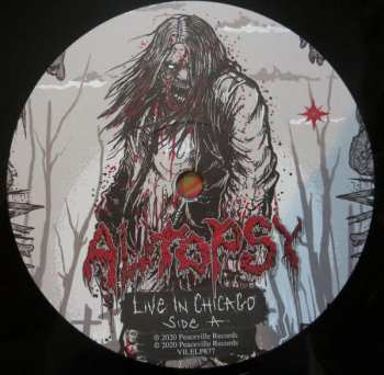 2LP Autopsy: Live in Chicago 