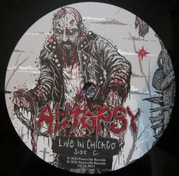 2LP Autopsy: Live in Chicago 