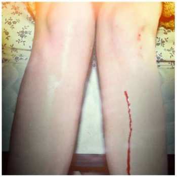 Album Los Campesinos!: Romance Is Boring