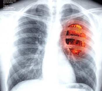 Album Massimo Zamboni: L'Estinzione Di Un Colloquio Amoroso