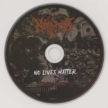 CD Nephrectomy: No Lives Matter