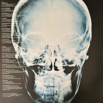 LP Nerone: Penkiller