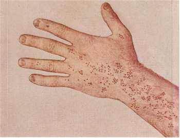 CD Nick Forté: Young Man's Disease