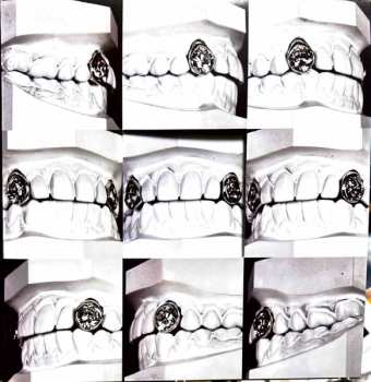 2LP Post Malone: The Diamond Collection CLR