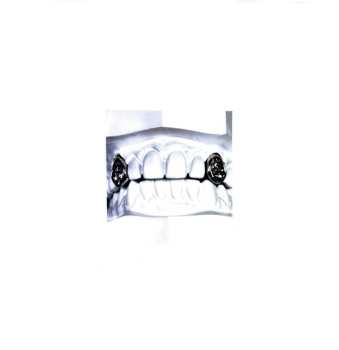 2LP Post Malone: The Diamond Collection CLR