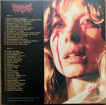 LP Regurgitate: The Torture Sessions LTD