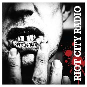 Album Riot City Radio: Spitting Teeth