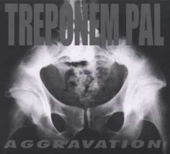 CD Treponem Pal: Aggravation LTD | NUM | DIGI